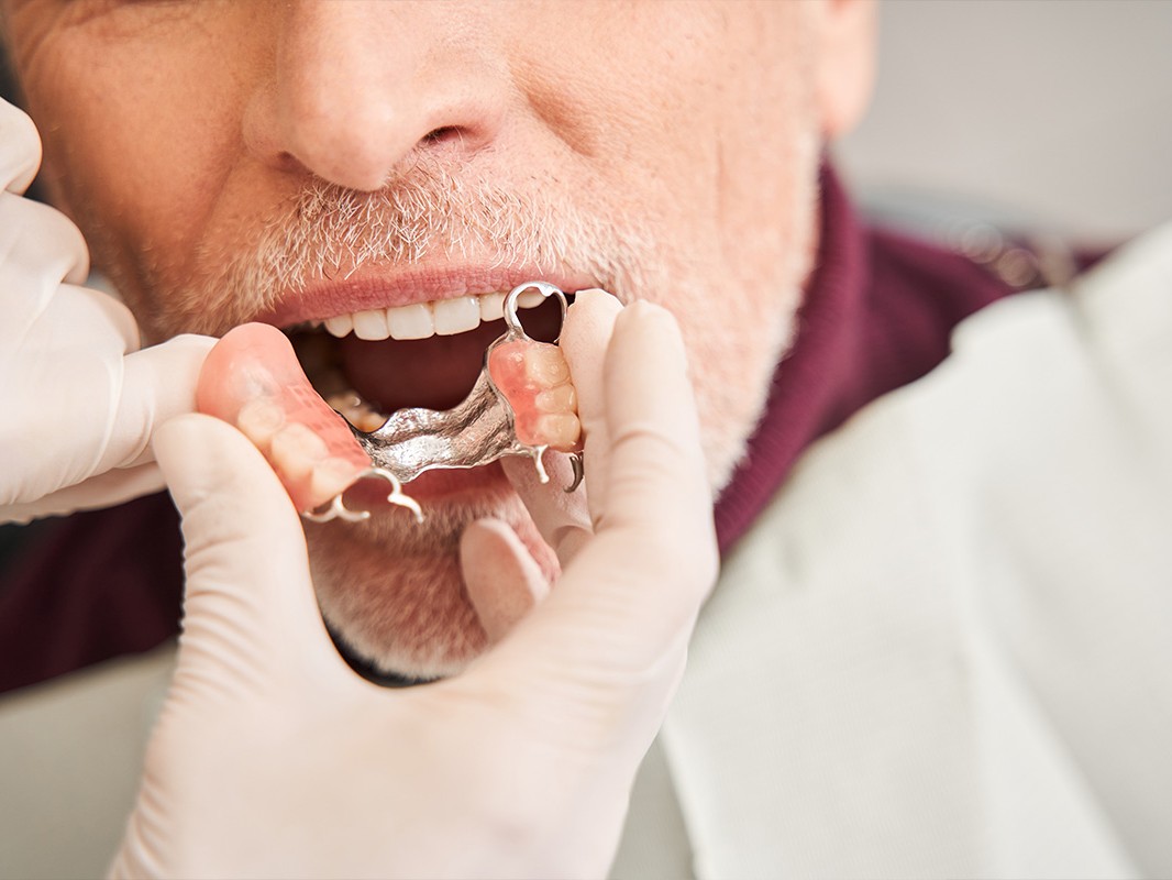 Dentures