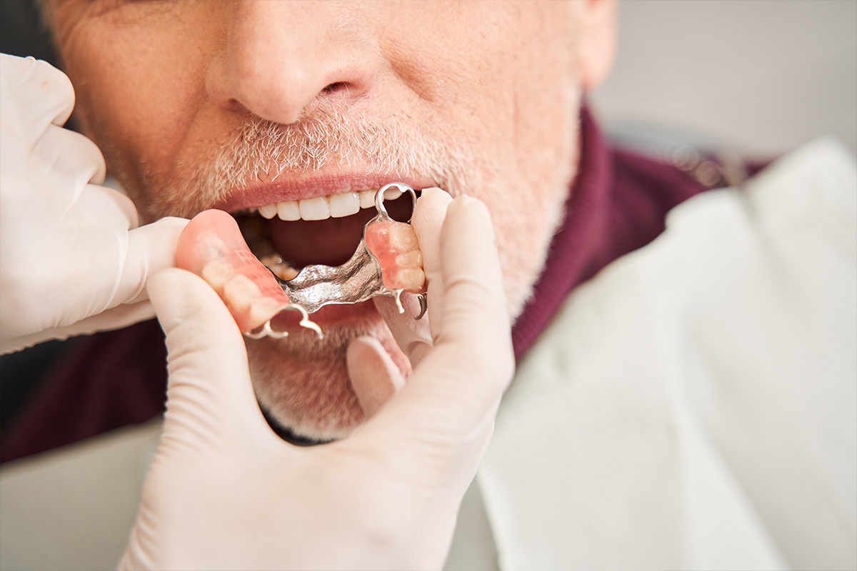 Dentures