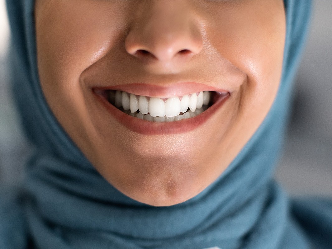 Teeth Whitening Treatment