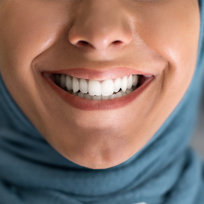 Teeth Whitening Treatment